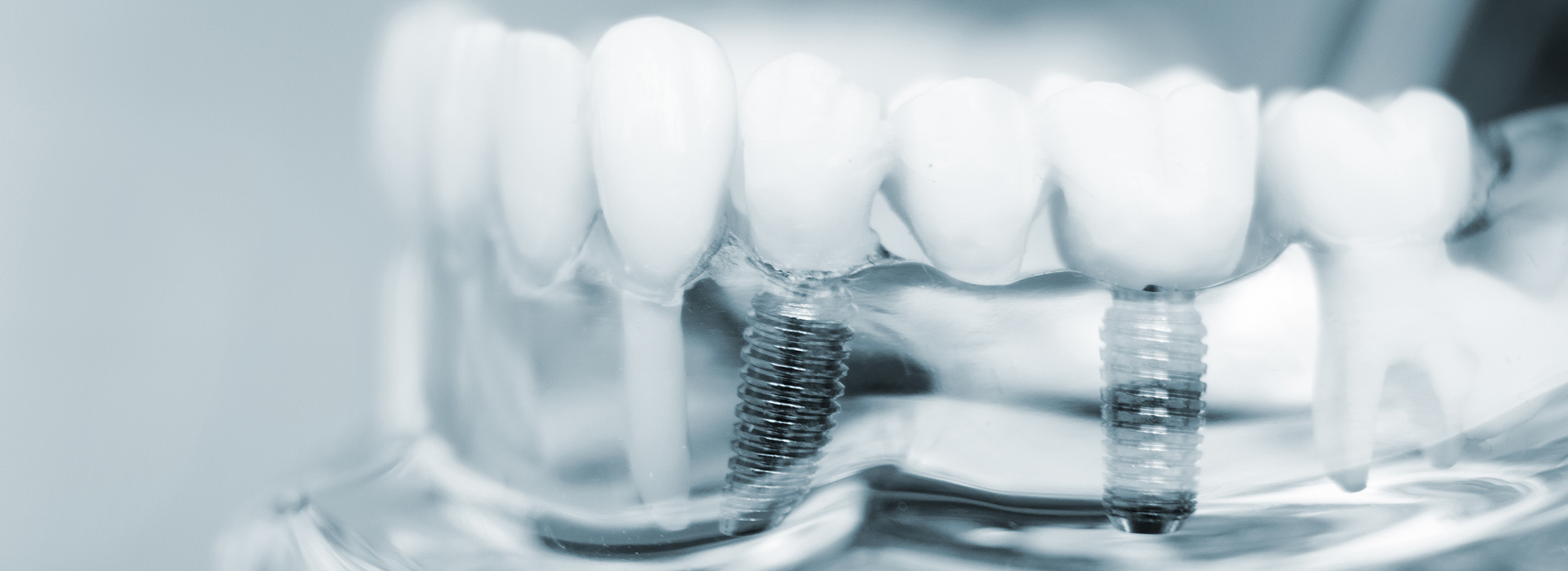 North Texas Dental Care | Sedation Dentistry, CEREC   and Dentures